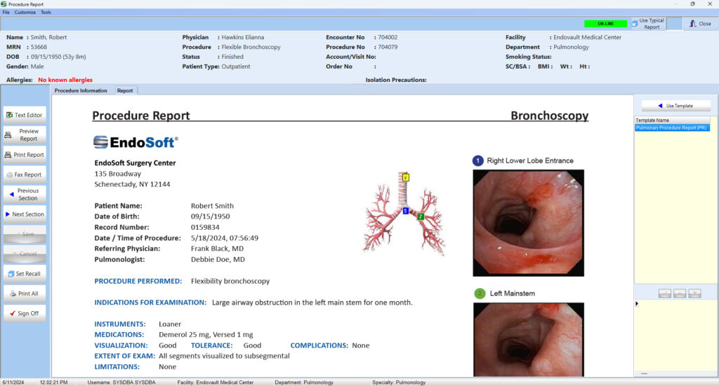 Medical procedure report screen for a bronchoscopy from EndoSoft.