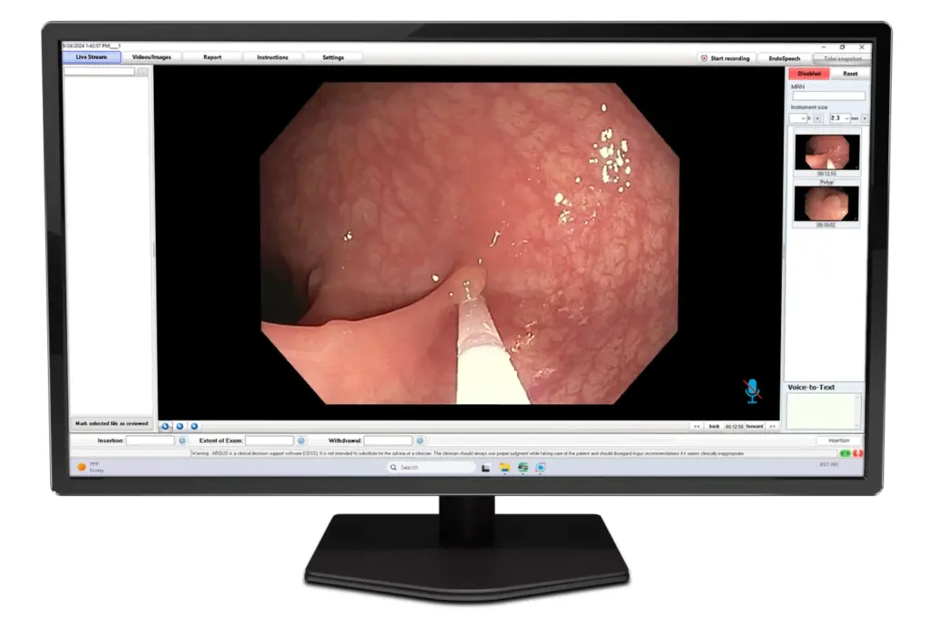 a computer monitor showing the image capture screen of Argus, AI powered by EndoSoft, showing an EGD procedure