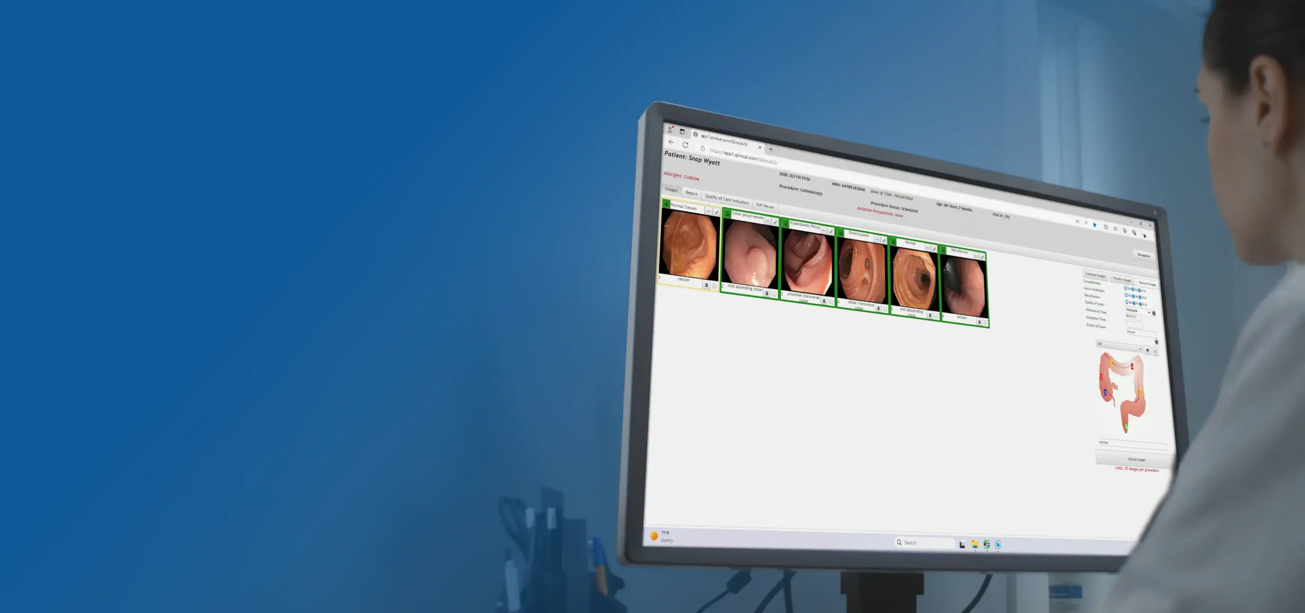 Medical office showing a computer with Qlinical Image capture management on screen