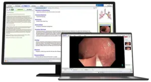 A laptop and computer monitor showing Argus Artificial intelligence for procedure documentation and image capture software