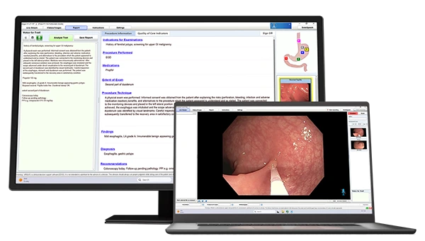 A monitor and laptop screen showing Argus AI gastroenterology emr software with natural language processing and image capture respectively