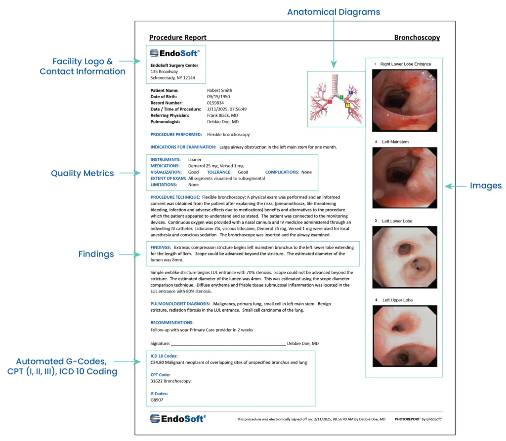 Bronchoscopy Procedure report example with labels of each section