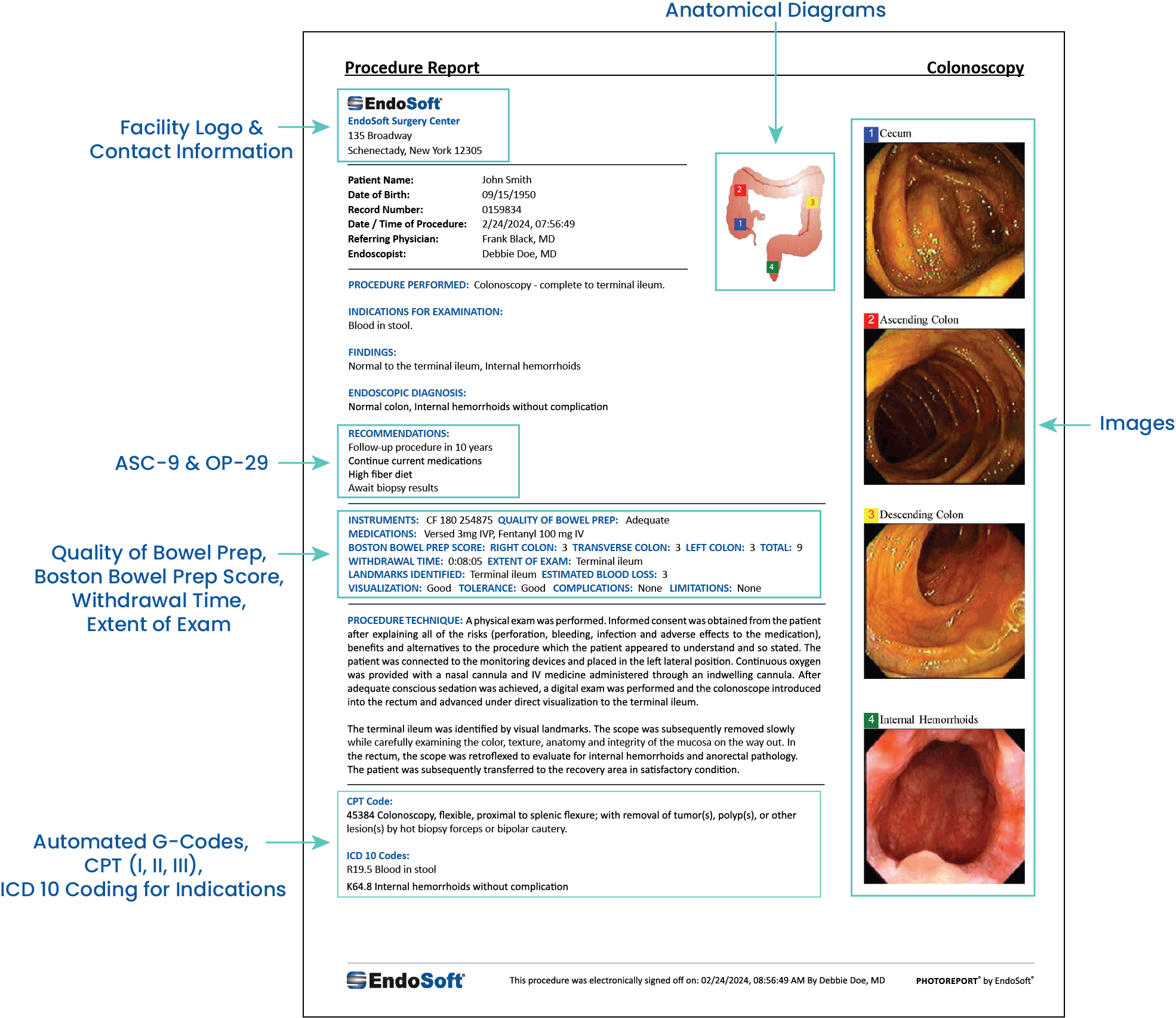 GI Procedure report example with labels of each section