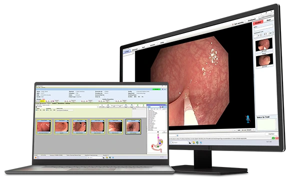 A laptop and computer monitor showing EndoVault image capture and Argus image capture software respectively. Medical Imaging Software