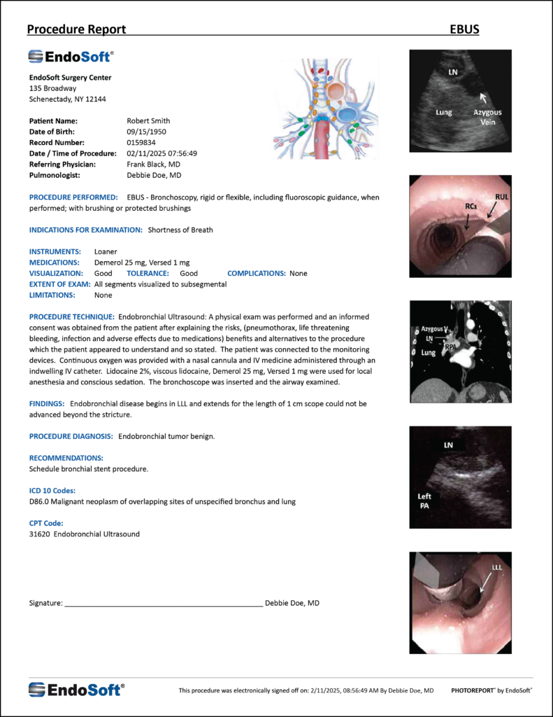 I demo image of a EBUS pulmonology procedure report showing advanced procedure images and documentation.