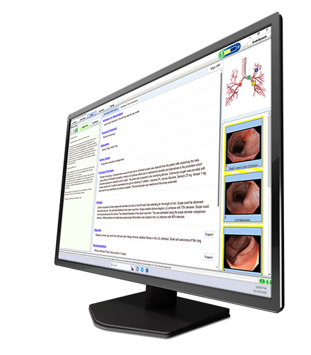 Argus intelligent report writer pulmonology software